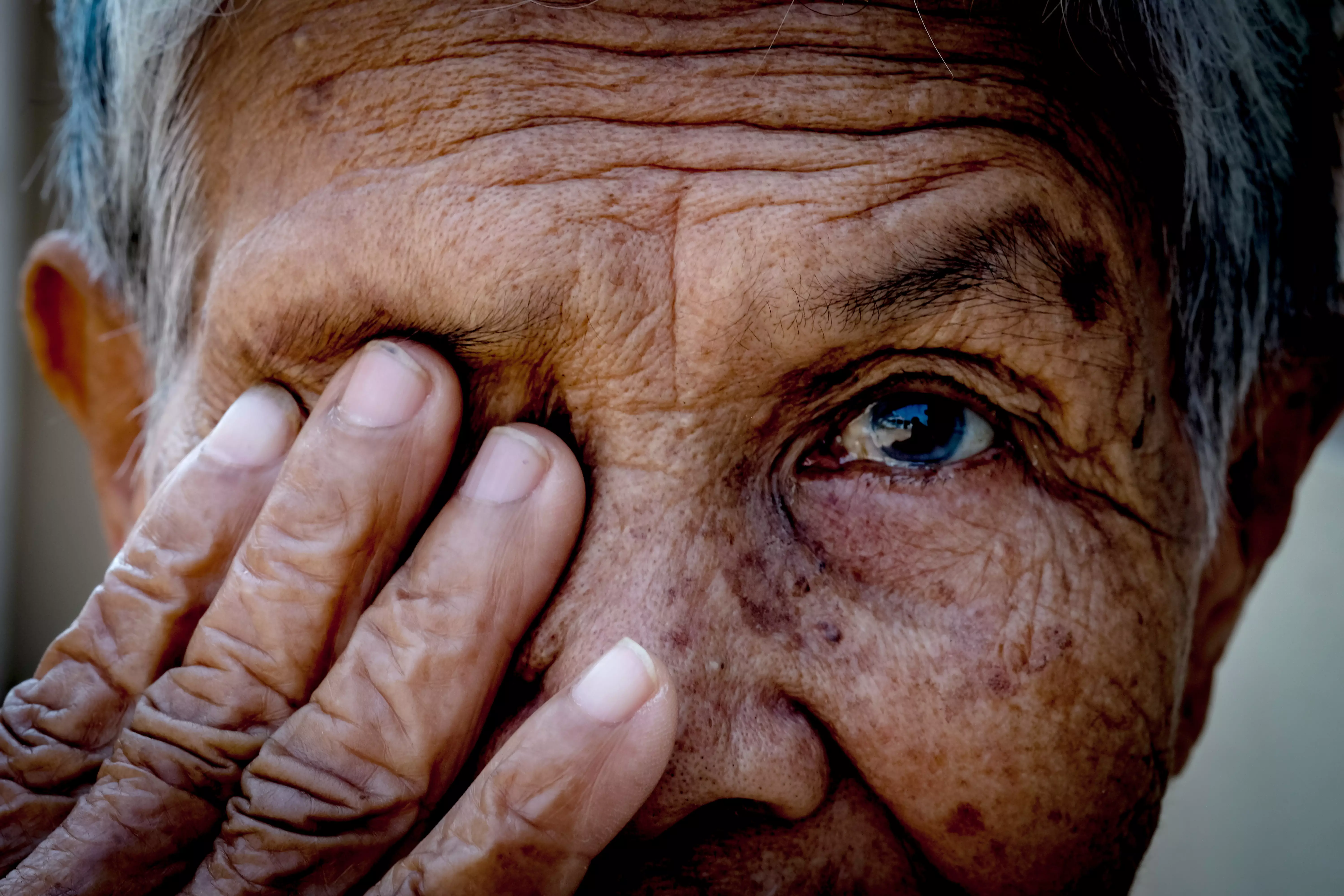 What is glaucoma?