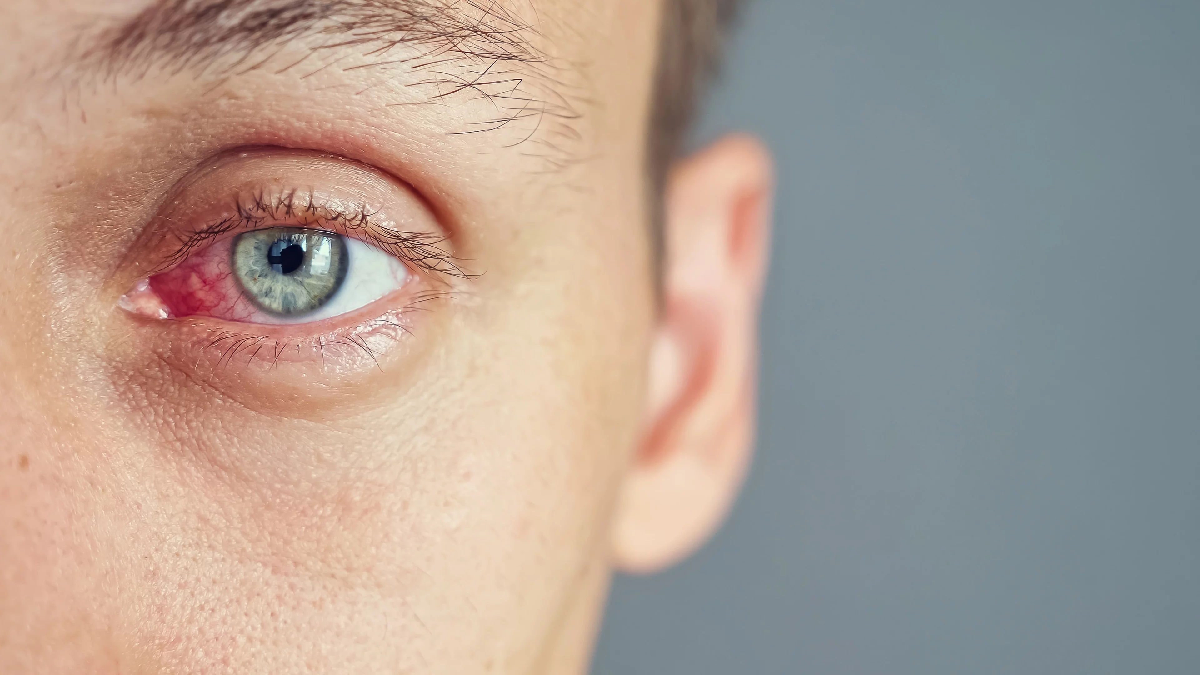 Trockenes Auge